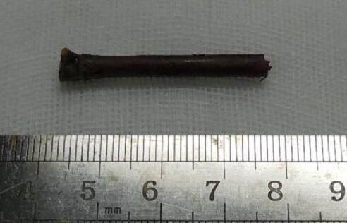 “小小竹棍把我害的好苦啊!幸好，遇到了厦门眼科中心眼整形科的胡继发副主任。医术好、态度好。大医院 医生就是不一样!”——医治眼睛后的老李激动的说道2.jpg