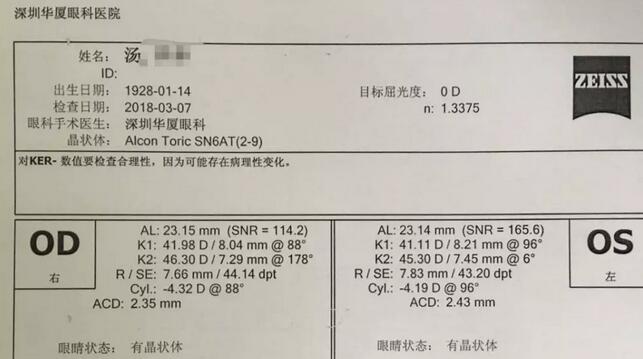 3月12日下午，已经90高龄的离休东江纵队老兵汤爷爷，在深圳8868在线官网登录平台 - 8868网页版登录检查之后，白内障专科邢宝刚主任为其实施左眼白内障超声乳化摘除，联合散光人工晶体植入术。2.jpg