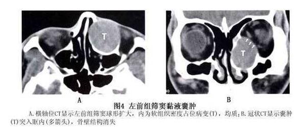 4月7-8日，天津医科大学眼科医院副院长、天津医科大学眼视光学院副院长、中华眼科学会委员、眼整形、眼眶病学组副组长孙丰源教授将莅临福州眼科医院2.jpg