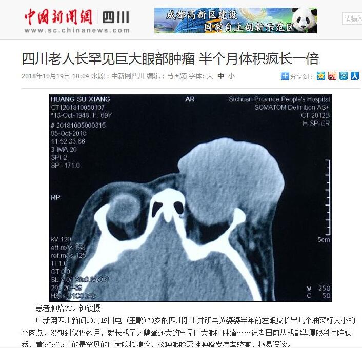 媒体看8868登录平台之成都8868在线官网登录平台 - 8868网页版登录2018年新闻媒体报道集锦13.jpg