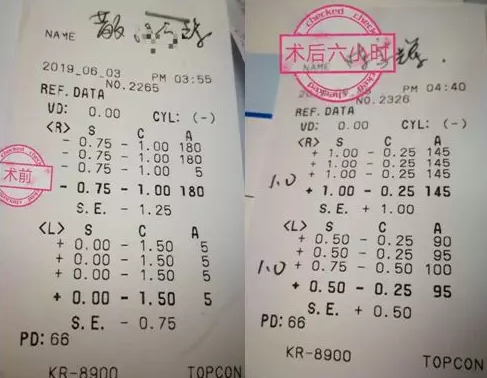 福州眼科医院近视手术取样：视力不差、无法通过参军公考体检群体该怎么办1.png