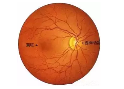 8868登录平台福州眼科医院眼底病医生：老年黄斑变性该如何防治？.png