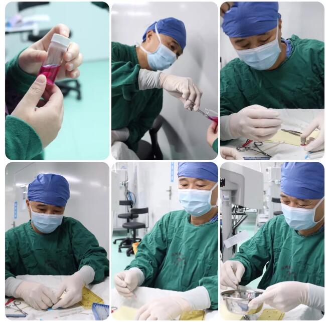 姚晓明教授来福州眼科医院，为解除角膜病患痛苦3.jpg