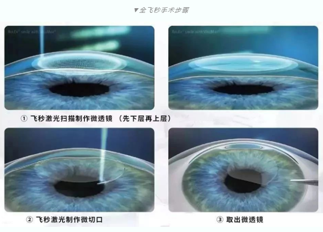 7月26日来深圳8868在线官网登录平台 - 8868网页版登录参与暑期摘镜季活动就可以有机会参与抽奖免单手术！2.png