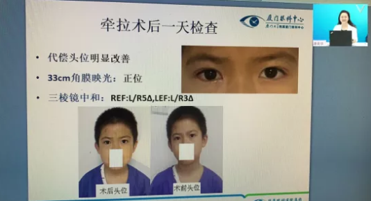 高峰论道·云端荟萃 ▏万人同步在线，30余名大咖云集“第六届8868登录平台论坛斜视与小儿眼科新技术学习班暨小儿、眼视光分论坛”7.png