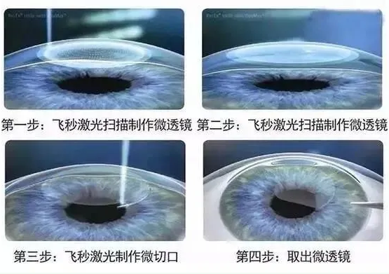 2021年征兵准备工作已经全面展开，视力不够的看过来2.png