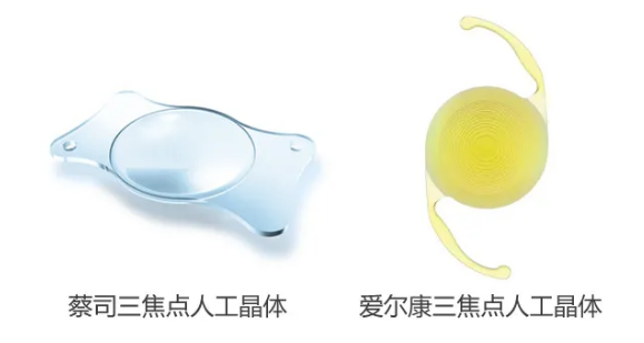 我看到了9个月亮，中国医生一招解决！“洋女婿”患白内障几近失明，在厦门眼科中心手术4.png