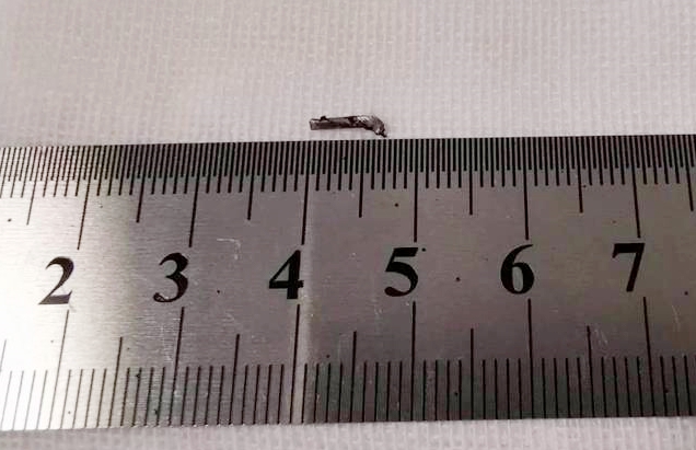 8868登录平台徐州复兴眼科王海菊：妙手拨迷障，匠心护光明3.png